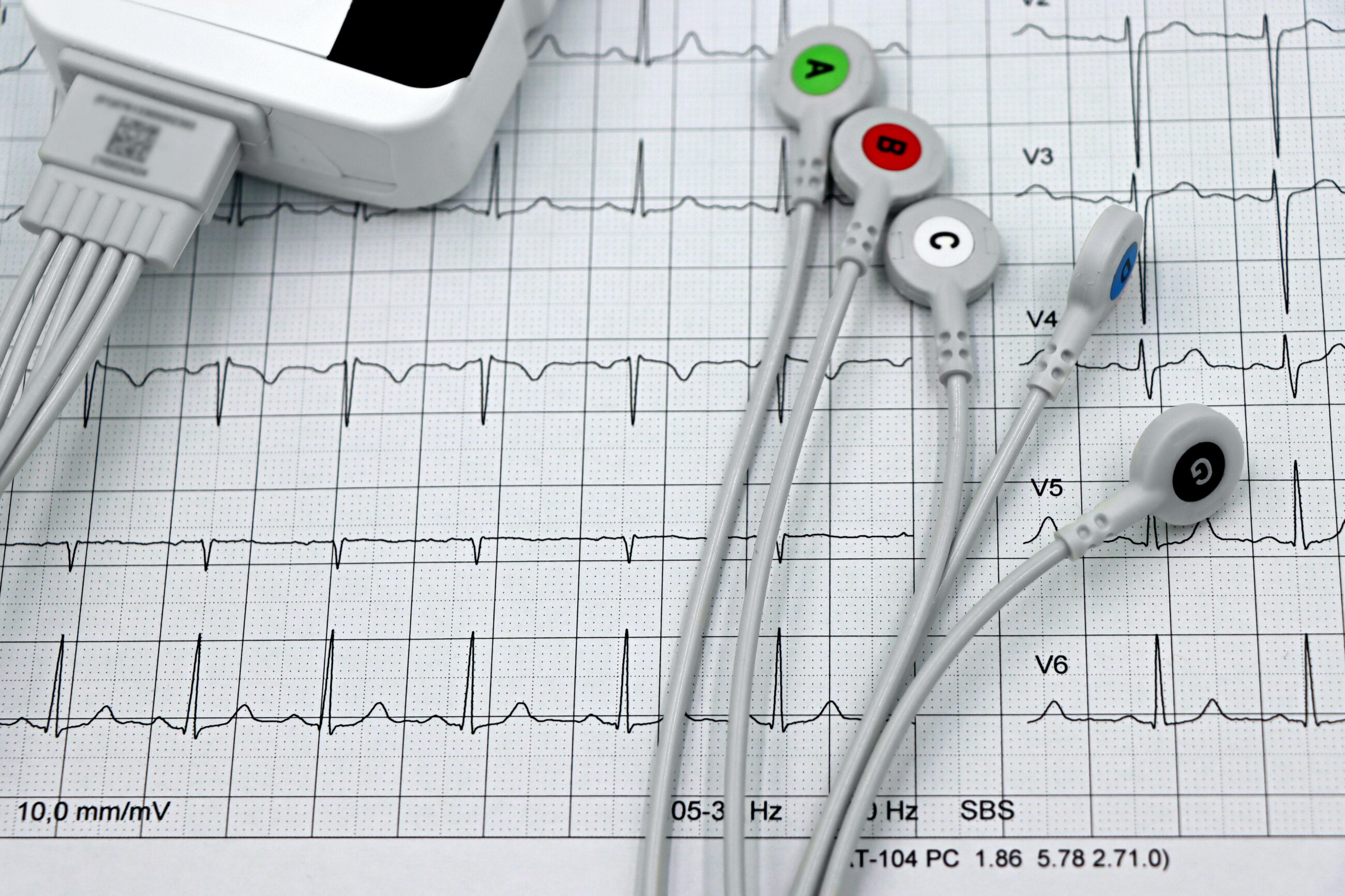 X-Ray or ECG (Optional)