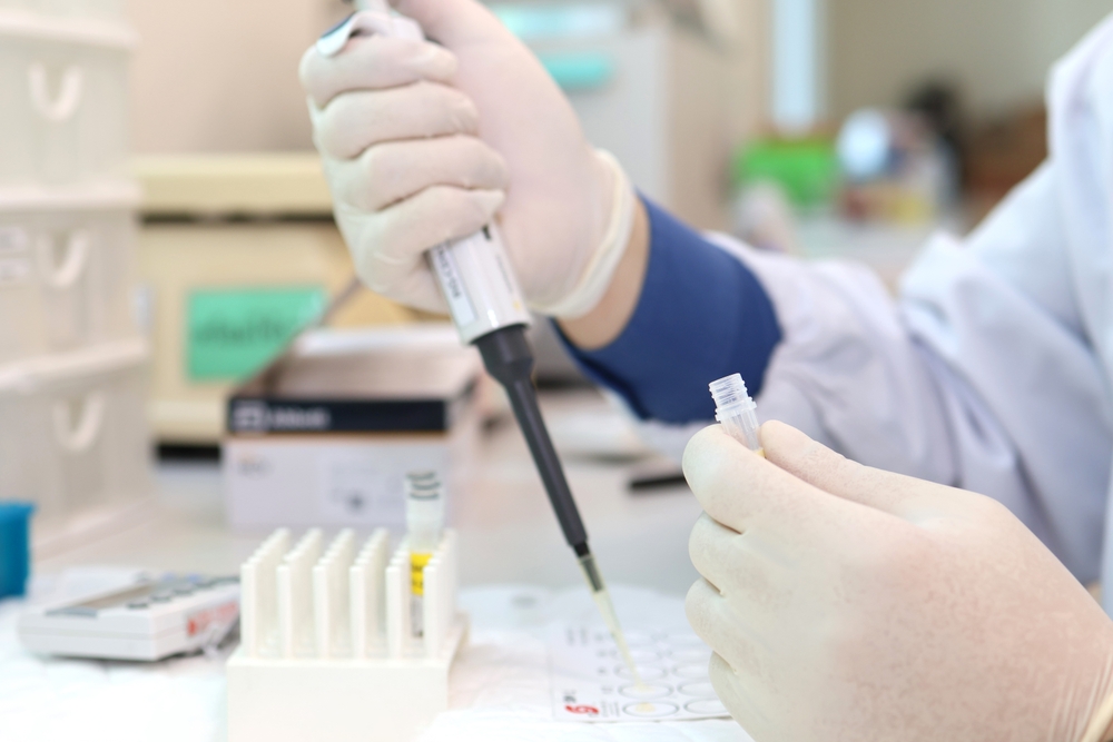 Rapid Tests vs. Laboratory Tests