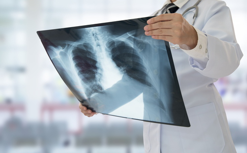 What Is X-Ray Imaging and Why Is It Important